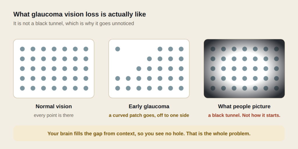 Three panels comparing normal vision, early glaucoma where a curved patch of side vision is missing, and the black tunnel people wrongly picture