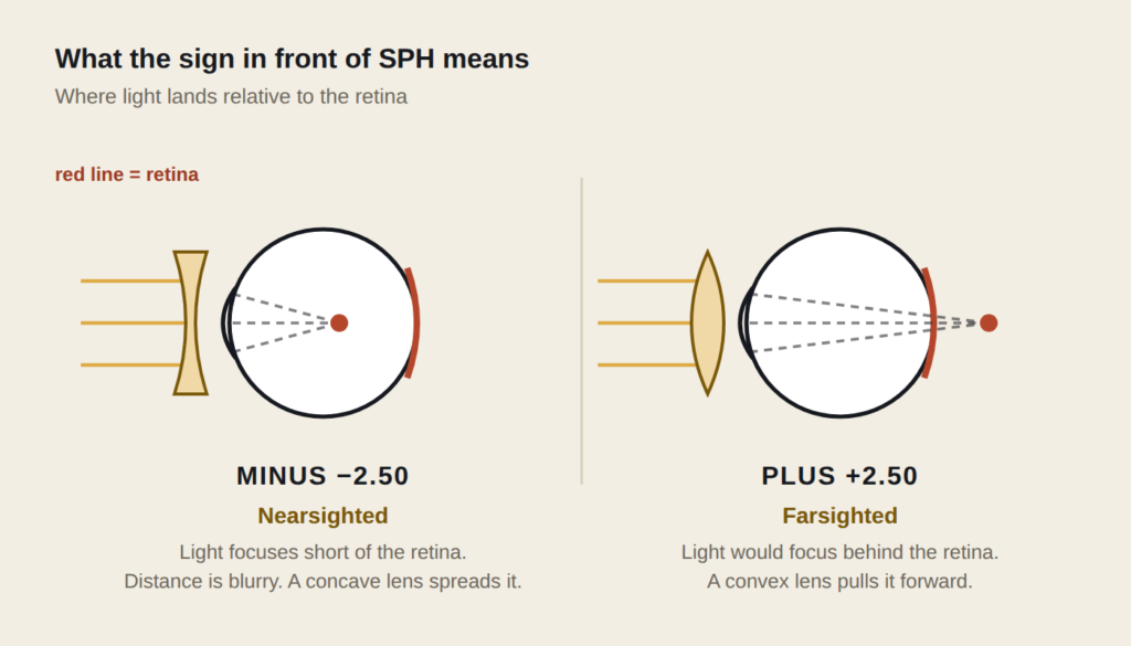 Diagram of a nearsighted eye focusing light short of the retina and a farsighted eye focusing behind it, with the concave and convex lenses that correct each
